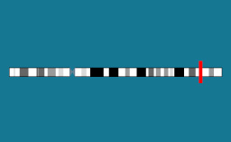 Gène FGFR2 sur le chromosome 10