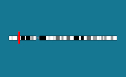 Gène CDKN1B sur le chromosome 12