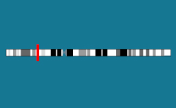 Gène CYP21A2 sur le chromosome 6