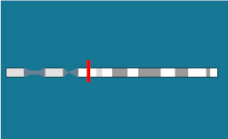 Gène TBX1 sur le chromosome 22