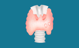 Nodules thyroïdiens