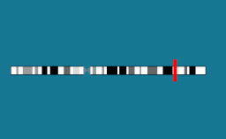 Gène IGSF1 sur le chromosome X