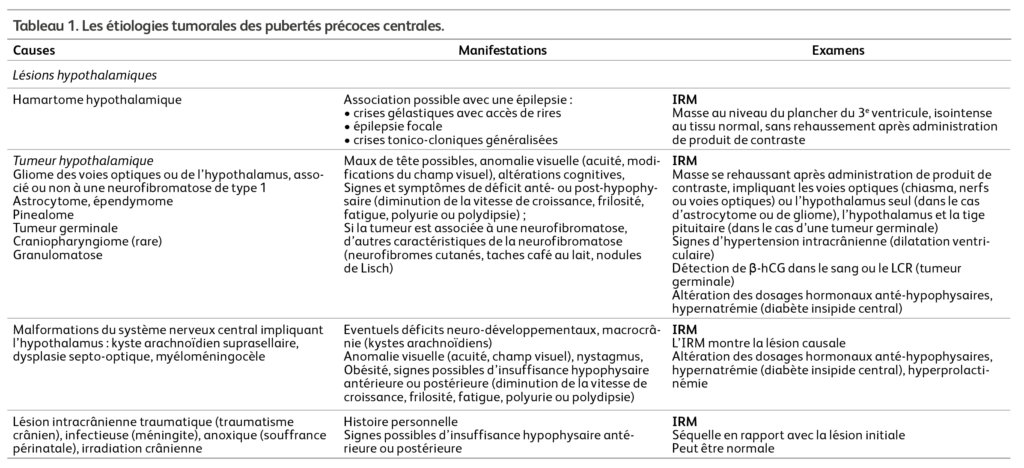 Etiologies tumorales des pubertés précoces centrales