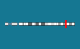 Gène ACAN sur le chromosome 15
