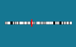 Gène ROBO1 sur le chromosome 3