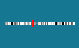 Gène ROBO1 sur le chromosome 3